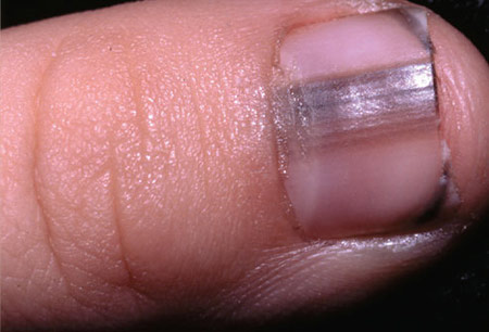 "Dị nhân" chẩn bệnh qua móng tay - 3