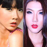 Ngọc Quyên lại thẩm mỹ độn cằm?