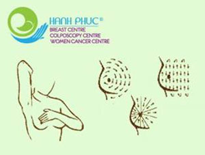 Cách tự kiểm tra giúp phát hiện ung thư vú - 2