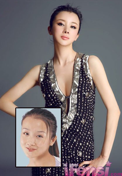 Di chứng thẩm mỹ đáng sợ của sao Hoa ngữ, Làm đẹp, tham my, hau qua tham my, sao tham my, sao hoa ngu tham my, tham my mat, hau qua tham my mat, got cam, got mat, di chung tham my,