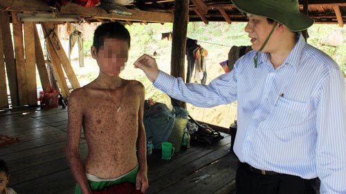 "Bệnh lạ" Quảng Ngãi: Nghi do gạo mốc - 3