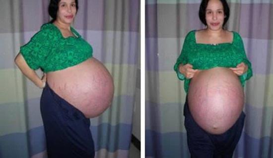 Sốc: Bà mẹ mang bầu 9 em bé, Phi thường - kỳ quặc, chuyen la, chuyen la the gioi, mang bau, bau 9 nguoi con, mexico, ba me, bao thai, nguoi con, em be, mang thai, tin tuc