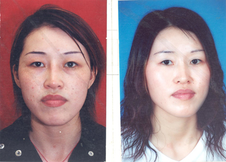 Hiệu quả trị nám, tàn nhang, đồi mồi trong đông y, Sức khỏe đời sống,