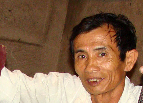 Chữa rắn độc cắn chỉ bằng 'hà hơi thổi ngạt', Tin tức trong ngày, rắn độc,cắn,mặt sưng vù,cứu sống,hà hơi thổi ngạt