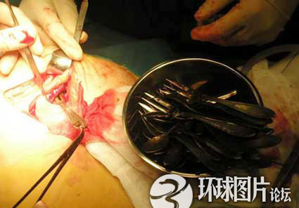 Những DỊ NHÂN...ăn tạp - 3