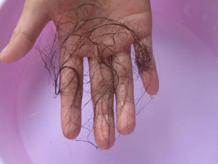 6 biểu hiện “thận hư” ở phái nữ, Sức khỏe đời sống, suc khoe, benh than, bong mat, tien man kinh, cam lanh
