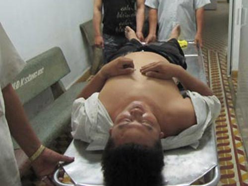 Bắt băng trộm xe, "hiệp sĩ" bị đánh bất tỉnh - 1