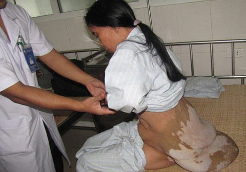 Những người khốn khổ vì suốt đời "cõng" u - 3