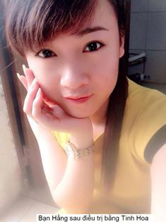 "Siêu bí kíp" đánh bay mụn trứng cá cực kỳ đơn giản - 4