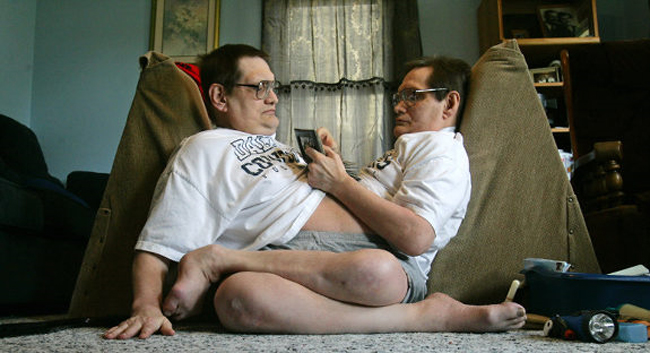 14. Cặp sinh đôi dính liền sống thọ nhất
Anh em nhà Siamese gồm Ron (bên trái) và Don đang nắm giữ kỉ lục Cặp sinh đôi dính liền sống lâu nhất. Họ đến từu Ohio, Mỹ. 
