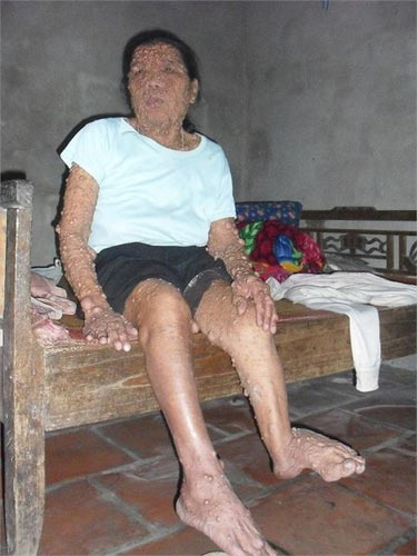 Người đàn bà mang "thân hình quỷ" ở Hà Nam - 1