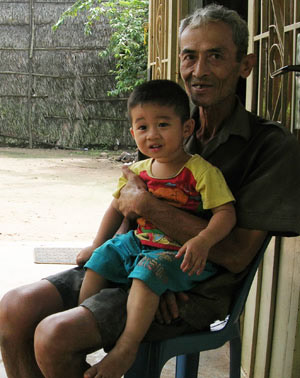 Bé 2 đầu: BS thiếu sót khi siêu âm thai - 2
