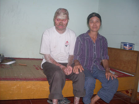 Người mang hình hài tượng phật ở Hải Phòng - 1