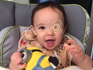 Tin tức trong ngày - Cảm động tình yêu của cha dành cho bé một mắt