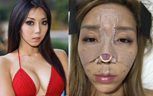 Thẩm mỹ viện - DJ sexy nhất Malaysia tung ảnh phẫu thuật đau đớn