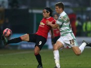 Bóng đá - MU: Khi Falcao trở lại để.. ra đi