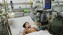 Sức khỏe đời sống - Không biết con bị hen suyễn nặng, 3 trẻ gặp nguy hiểm