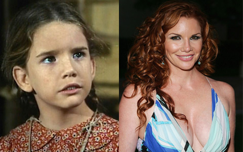 Thẩm mỹ viện - Sao "Ngôi nhà nhỏ trên thảo nguyên" tháo bỏ “ngực giả“