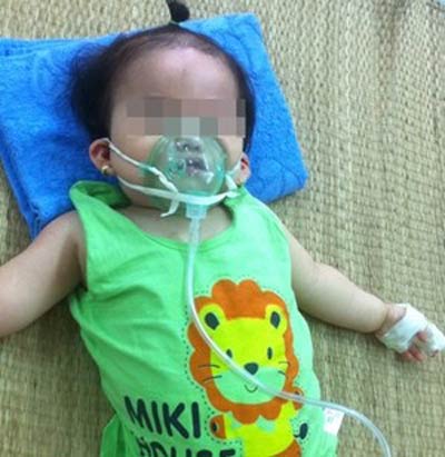 Sức khỏe đời sống - Nhận biết sớm các dấu hiệu viêm phổi ở trẻ nhỏ