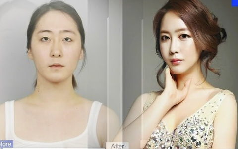 Thẩm mỹ viện - Bất ngờ với ca chuyển giới ngoạn mục xứ Hàn