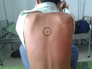 Pháp luật - Một thanh niên tố bị công an xã bắn, đánh phải nhập viện