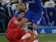 Bóng đá - Đá xấu Liverpool, Diego Costa sẽ bị treo giò 3 trận