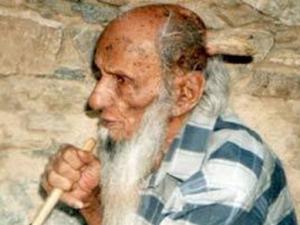 Phi thường - kỳ quặc - Cụ ông 102 tuổi 2 lần bị mọc sừng trên đầu