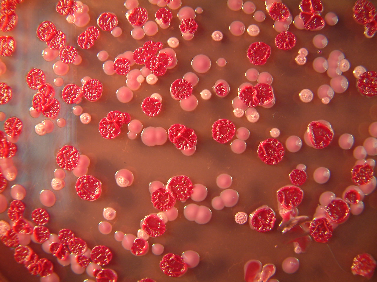 Tin tức trong ngày - Mỹ: Phòng thí nghiệm để lọt vi khuẩn chết người ra ngoài