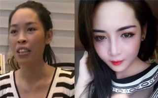Cô gái Nam Định xinh đẹp bất ngờ sau 3 tháng “dao kéo“