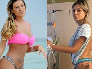 Xu hướng thời trang - Á hậu Siêu vòng 3 lại vào viện vì hoại tử “bàn tọa"