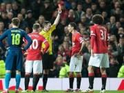 Bóng đá - MU gục ngã FA cup: Van Gaal nên chuẩn bị đơn từ chức