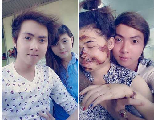 Bạn trẻ - Cuộc sống - Chuyện tình chàng trai và cô gái mặt bị hủy hoại gây “bão“