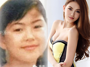 Làm đẹp - Lộ ảnh cũ tố vợ Châu Kiệt Luân phẫu thuật thẩm mỹ