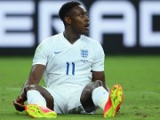 Bóng đá - Welbeck cười gượng sau pha &quot;ăn vạ&quot; bất thành