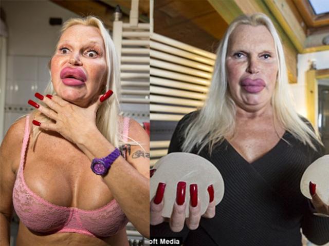 Thẩm mỹ viện - Người chuyển giới gây hoảng sợ vì vẻ ngoài biến dạng