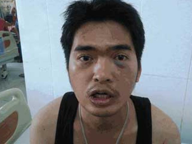 Pháp luật - Côn đồ đánh cả một gia đình để "dằn mặt" việc bán sim?