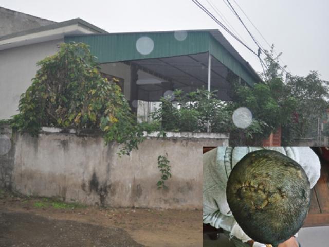 Pháp luật - Trước khi hành hung cha, mẹ kế, còn gọi điện báo CA