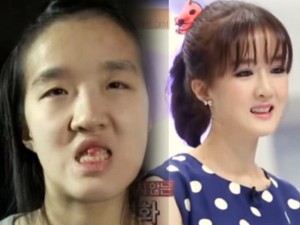 Thẩm mỹ viện - Bà mẹ Hàn Quốc xinh như hot girl sau khi ‘dao kéo’