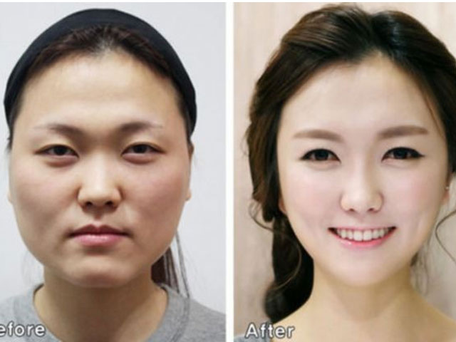 Ám ảnh ngoại hình của người dân Hàn Quốc