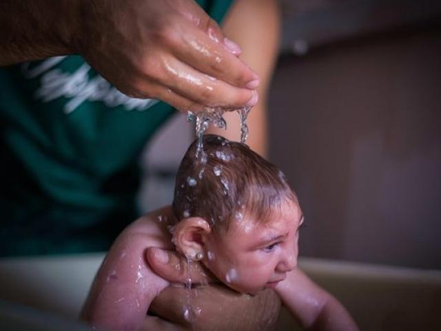 Thế giới - Xác nhận virus Zika liên quan tới chứng đầu nhỏ