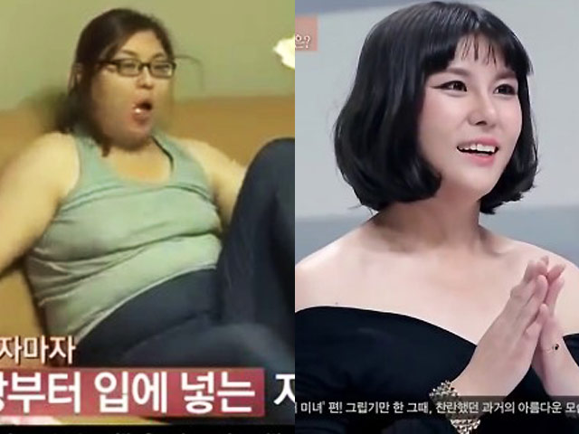 Thẩm mỹ viện - Bà mẹ nặng hơn 1 tạ xinh như minh tinh nhờ "dao kéo"