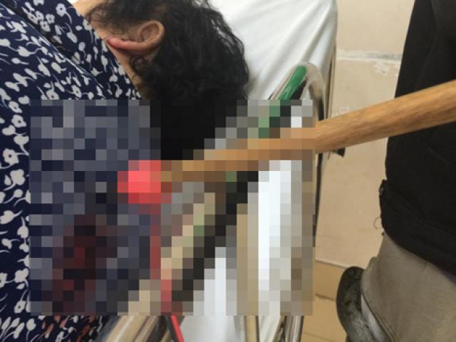 Pháp luật - Dùng tên bắn chó đâm bà lão, cướp giỏ xách