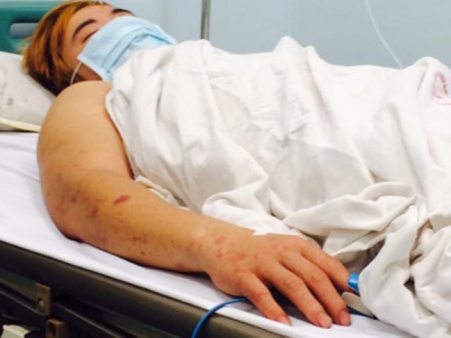 Tin tức trong ngày - Bệnh não mô cầu cực nguy hiểm đã lan tới Hà Nội