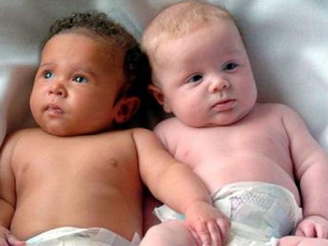 Phi thường - kỳ quặc - Những ca sinh đôi, sinh ba "mỗi con một bố khác nhau"