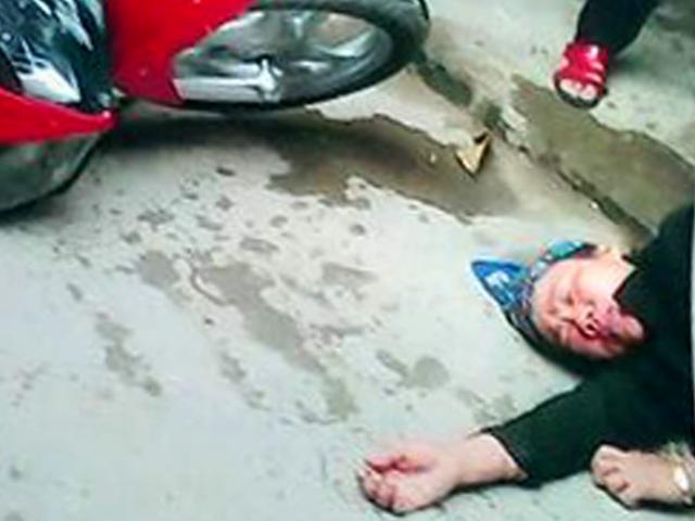 Pháp luật - Cô gái đánh mẹ chồng cũ nhập viện