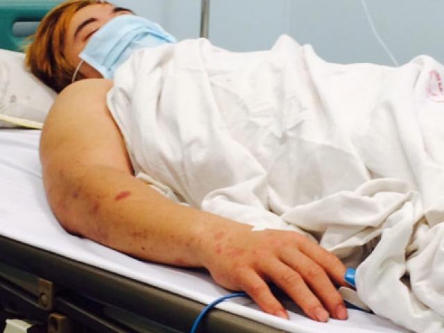 Tin tức trong ngày - Bệnh nhân mắc não mô cầu ở Hà Nội đã tỉnh táo hoàn toàn