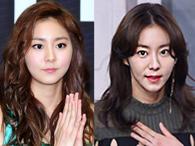 Thẩm mỹ viện - "Người đẹp bánh bao" gây sốc với mặt nhọn như xà tinh