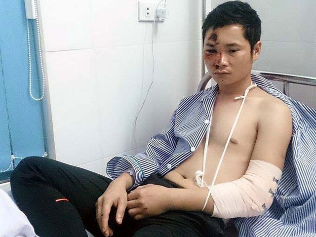 Pháp luật - Hải Phòng: Một giám đốc bị đánh chấn thương sọ não