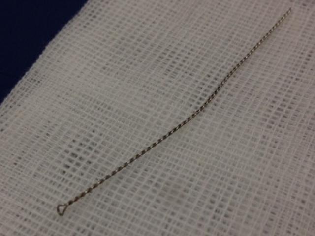 Sức khỏe đời sống - Hi hữu nhân viên lấy ráy tai xong phải đưa khách đi nhập viện