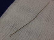 Sức khỏe đời sống - Hi hữu nhân viên lấy ráy tai xong phải đưa khách đi nhập viện